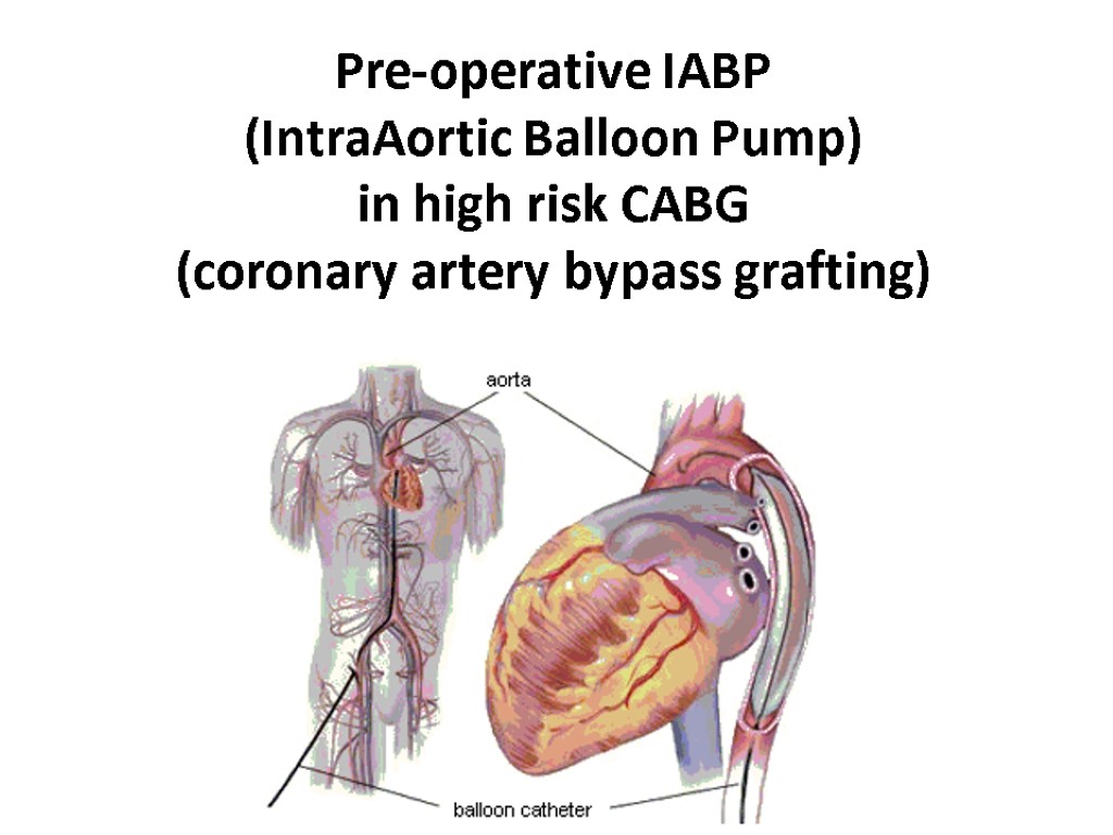 Pre-operative IABP (IntraAortic Balloon Pump) in high risk CABG (coronary artery bypass grafting)